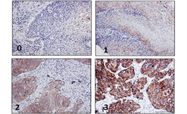 Nectin-4 在头颈部鳞状细胞癌中存在广泛表达
