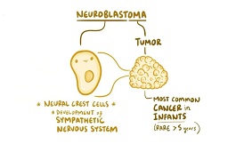 神经母细胞瘤：防复发药物DFMO临床试验招募中