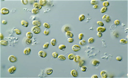 出国看病：Liso-Cel 在 R/R CLL/SLL 中引起一致反应