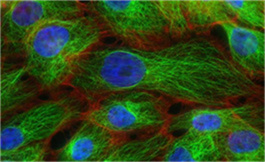 FDA 授予复发/难治性 AML 的 CB-102 快速通道称号